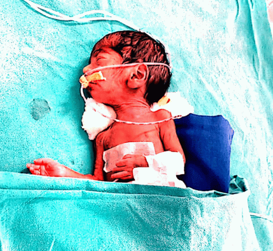 BABY-OF-ANIL-KASHINATH-AHER-6