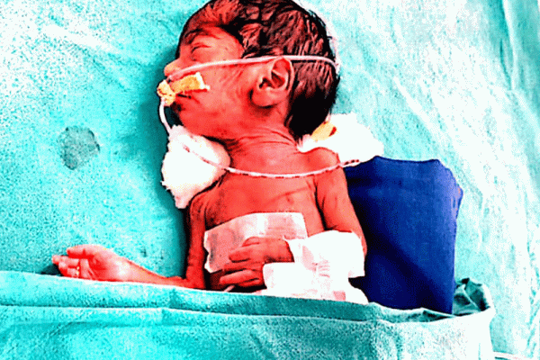BABY-OF-ANIL-KASHINATH-AHER-6