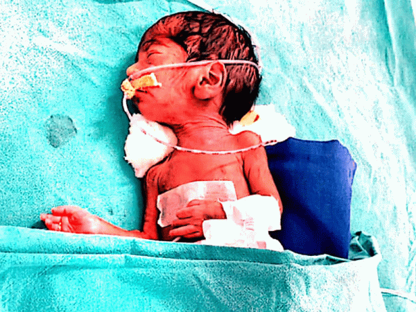 BABY-OF-ANIL-KASHINATH-AHER-6
