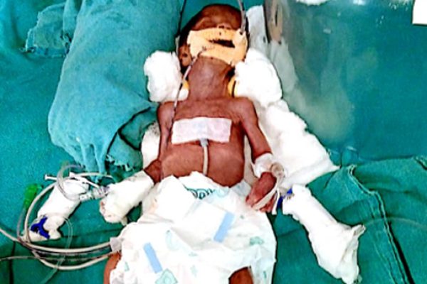 BABY OF TRISHALA VALMIK DENGLE