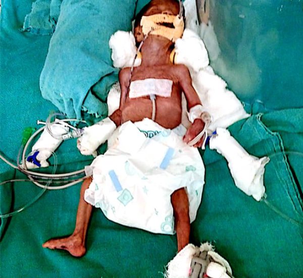 BABY-OF-TRISHALA-VALMIK-DENGLE-9