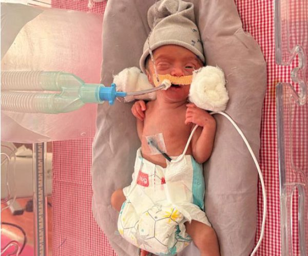 Baby-Of-Bendkoli-Sudam-Pandurang