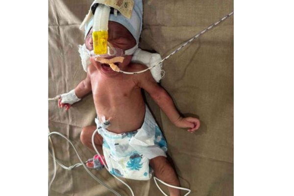 Baby-Of-Marle-Sadanand-Suresh-3