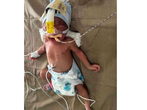 Baby-Of-Marle-Sadanand-Suresh-3