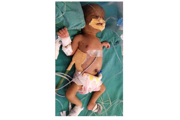 Baby-Of-Suvarna-Bablu-Sonawane