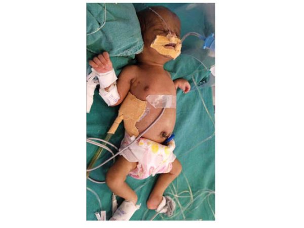 Baby-Of-Suvarna-Bablu-Sonawane