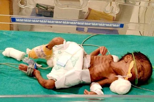 Baby-Of-satish-narayan-dusane-img